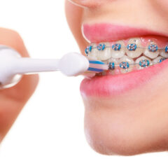 Jak pielęgnować zęby, nosząc aparat ortodontyczny?